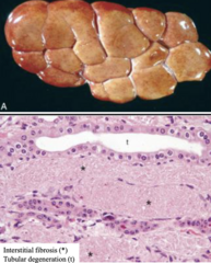 <p>This image is showing the renal affects of what toxin on bovine kidneys?</p>