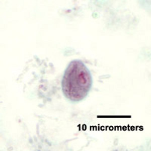 <p>6-10 um, Lemon shaped with nipple like projection, large single nucleus with distinct central karyosome. <u>Prominent cytostomal fibers (shephards crook)</u></p>