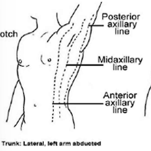 <ul><li><p>Anterior axillary line</p></li><li><p>Midaxillary line </p></li><li><p>Posterior axillary line</p></li></ul><p></p>