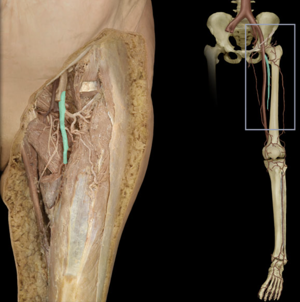 <p>Identify the blood vessel of the lower extremity</p>