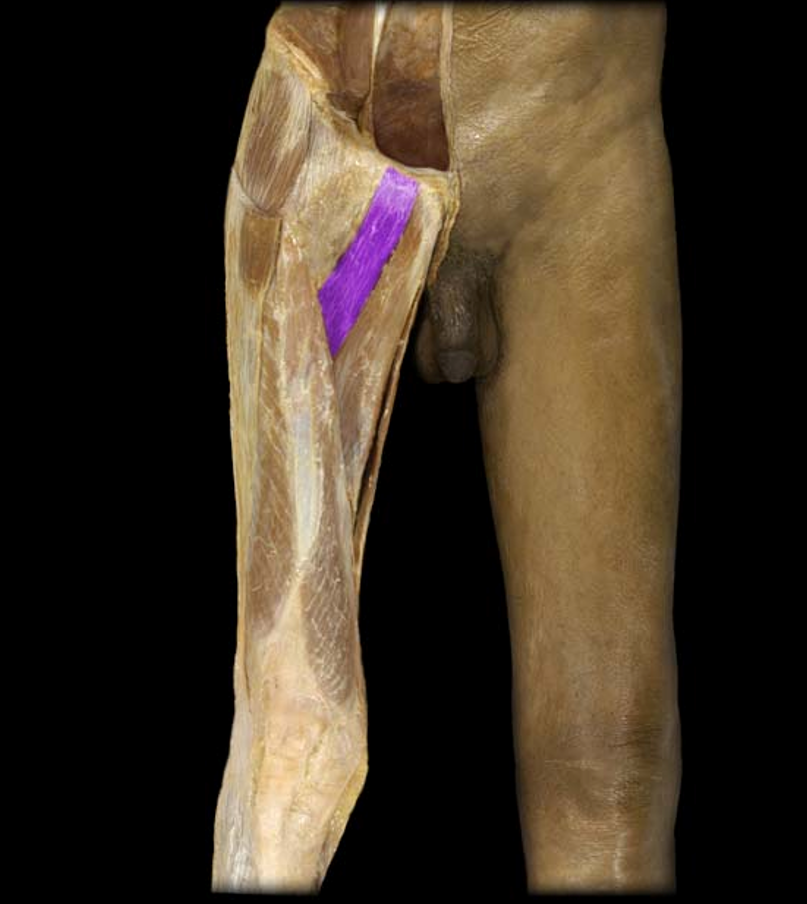 <p>What muscle is this?</p>