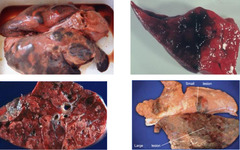 <p>Describe this pig lung and what is causing it?</p>