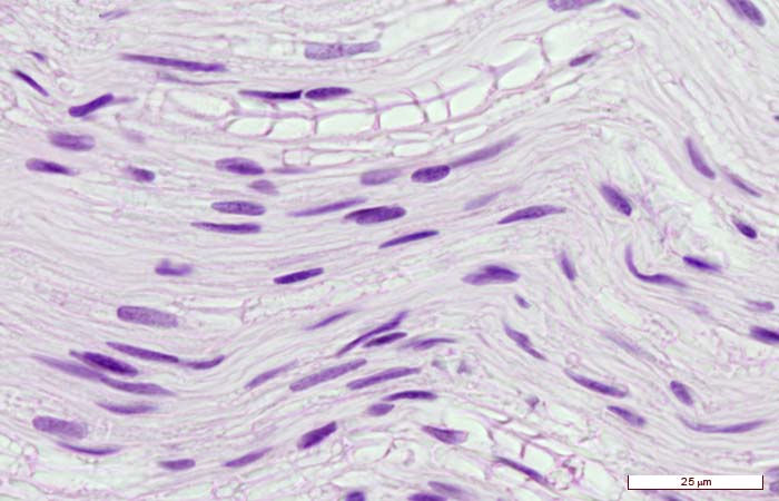 <p>Identifica la plaquita</p>