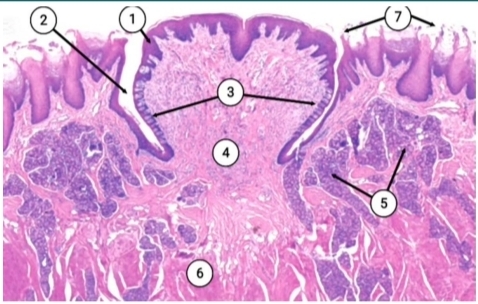 term image