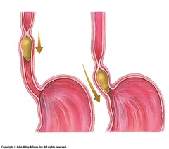<p>It regulates the passage of food into the stomach.</p>