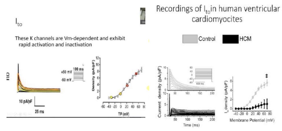 <p>La corrente I_{to} è la prima corrente di potassio ripolarizzante ed è responsabile della <strong>Fase 1</strong>.</p><p>• <strong>Caratteristiche:</strong> Ha un comportamento molto simile al canale del sodio, presentando un'attivazione e un'inattivazione voltaggio-dipendenti ed estremamente rapide. La sua soglia di attivazione è intorno a <strong>-35 mV</strong>. Genera una corrente di densità modesta (circa 10 pA/pF).</p><p>• <strong>Componenti:</strong></p><p>• Componente rapida: inattiva in 5 ms, sensibile alle 4-aminopiridine, non modulata dal calcio.</p><p>• Componente lenta: tipica dell'atrio o di condizioni patologiche ventricolari. Ha un'inattivazione nell'ordine dei 100 ms (si estende fino al plateau). È <strong>modulata dai livelli di calcio citosolico</strong> (aumenta all'aumentare del calcio per controbilanciarne l'ingresso).</p><p>• <strong>Variabilità Regionale e Patologia:</strong> La I_{to} è più marcata nell'epicardio rispetto all'endocardio, determinando durate diverse del potenziale d'azione nei vari strati del cuore. Nella <strong>cardiomiopatia ipertrofica</strong>, i cardiomiociti malati presentano un picco della corrente I_{to} drasticamente ridotto (es. 1 pA/pF contro i 6 pA/pF sani).</p>