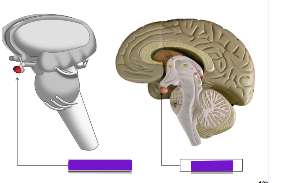 <p>what structure is highlighted on the right </p>