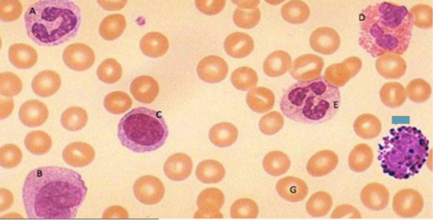 <p>Identify the following blood-formed element</p>