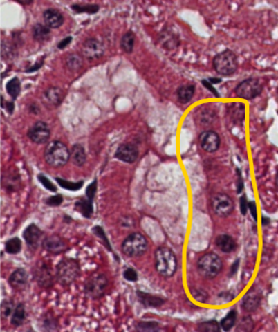 <p><span style="font-family: "Calibri Light";">Which type of epithelium is encircled in yellow?</span></p>