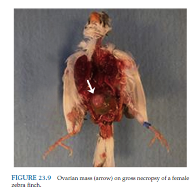 <p>overian tumor </p>