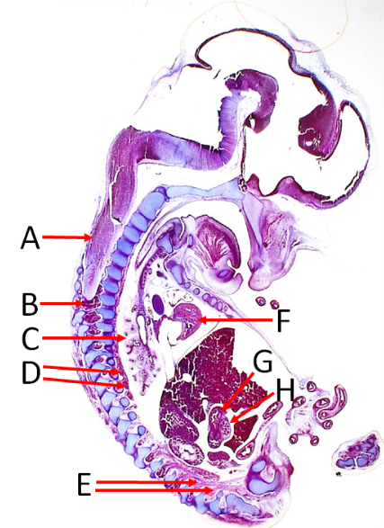 <p>Label A, B, C, D, E, F, G and H</p>