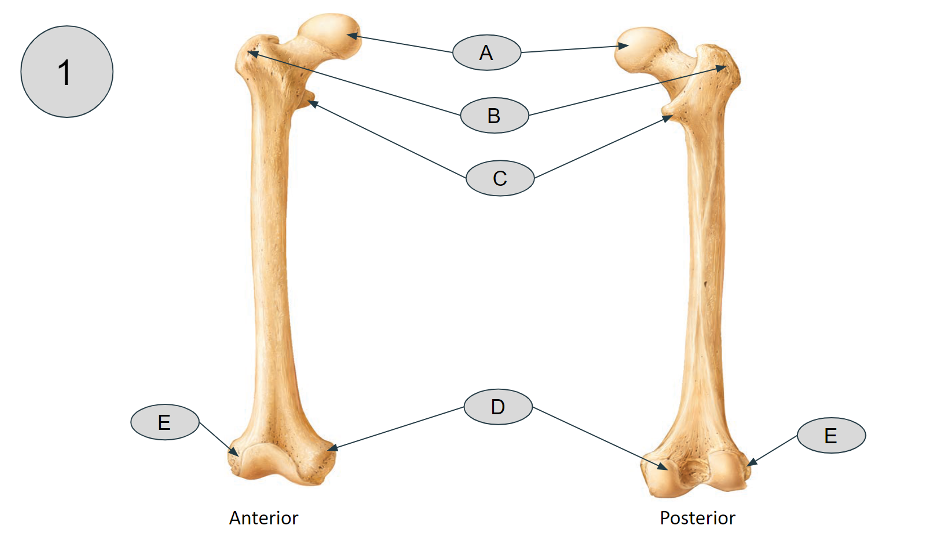 <p>Name these bones</p>