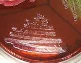 <p><strong><mark data-color="#f9f7f2" style="background-color: rgb(249, 247, 242); color: inherit;">Colorless / Amber</mark></strong> Colonies on EMB:</p>