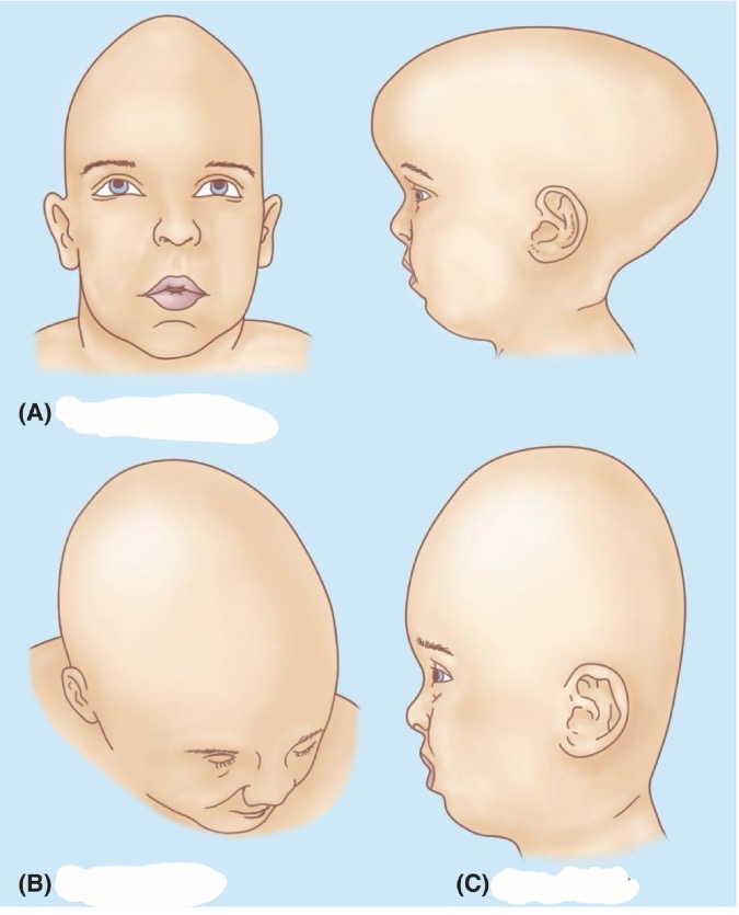 <p>A</p>