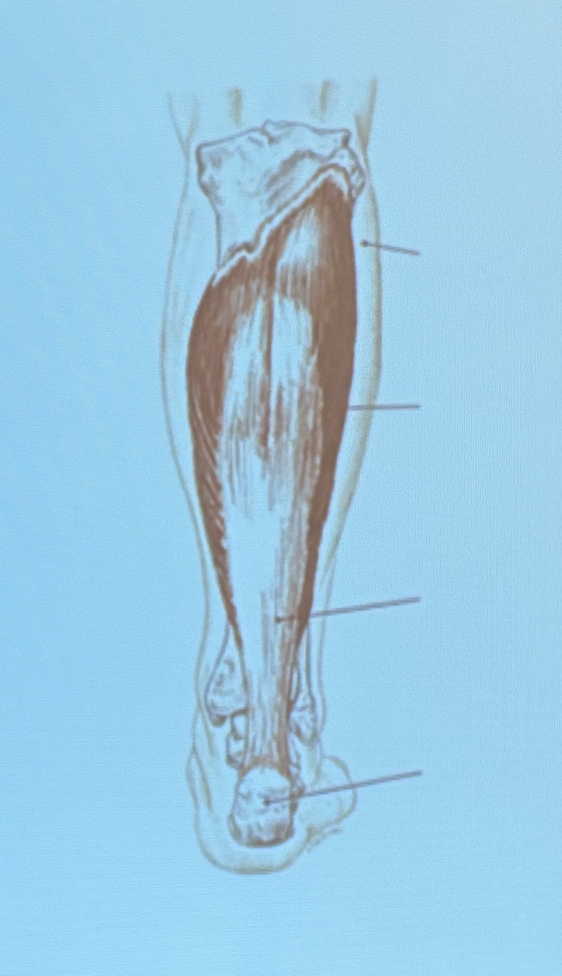 <p>Muscle name?</p>