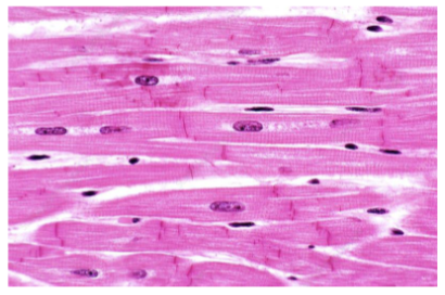 <p>Which muscle type is branched, myogenic, forms scar tissue, and pumps blood?</p>