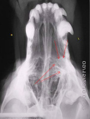 <p>Is this normal or abnormal?</p>