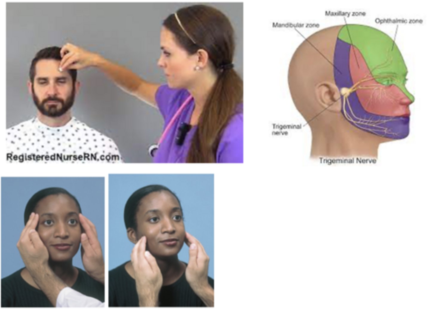 <p>Trigeminal (S/M)</p>