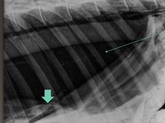 <p>A horse presents with increased respiratory effort, tachypnea, cyanotic mucous membranes, and distress. You see this on radiographs.</p>