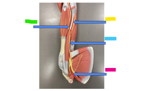 <p>What is the yellow arrow?</p>
