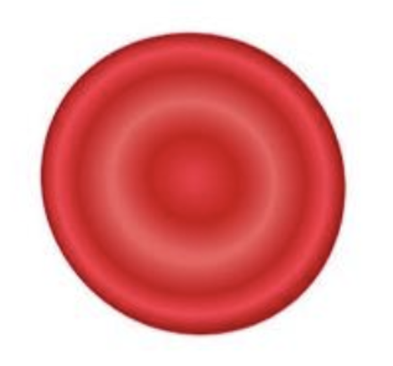 <p>Which Red Blood Cell is this?</p>