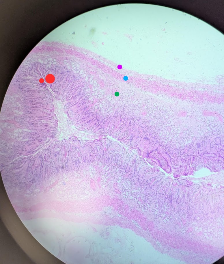 <p>Where in the body is this</p>