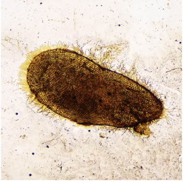 <p>Protozoa</p>