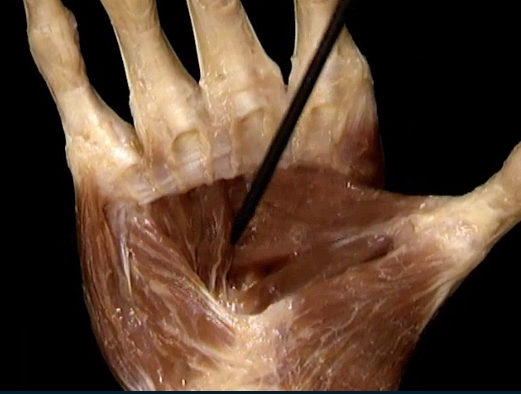 <p>Diep, Handpalm</p>