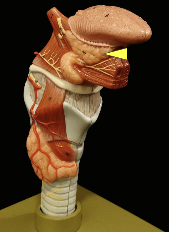 term image