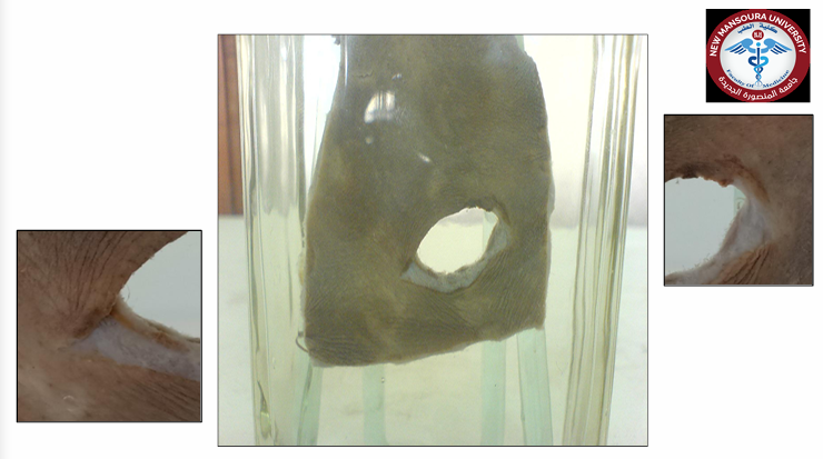 <p>Questions</p><ol><li><p>What is the specimen being examined?</p></li><li><p>What are the descriptive features of the injury on the skin?</p></li><li><p>What is the likely causative instrument for this type of injury?</p></li><li><p>How is the time of death estimated in relation to the injury?</p></li><li><p>What are the possible causes of death?</p></li><li><p>What is the final diagnosis for this specimen?</p></li></ol><p>.</p><p></p>