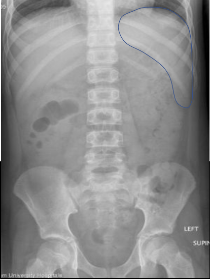 <p>What anatomy is outlined in this image?</p>