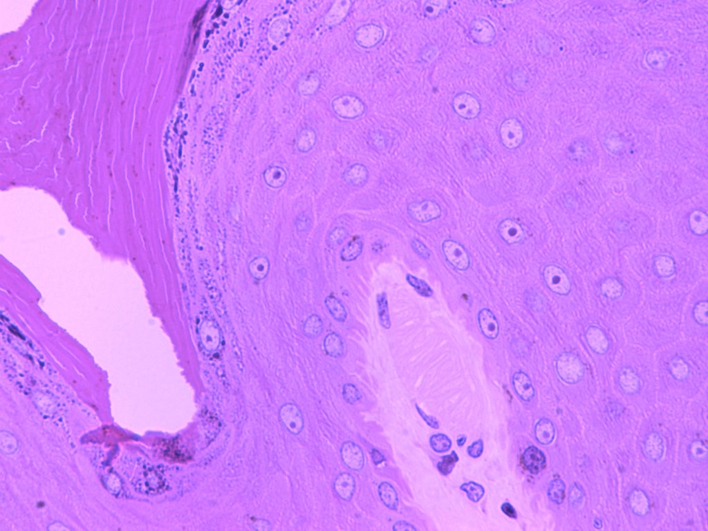 <p>Meissner’s Corpuscle</p>