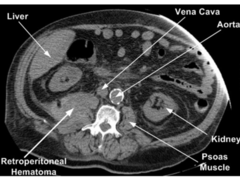 <p>organs between peritoneum/dorsal body wall</p>