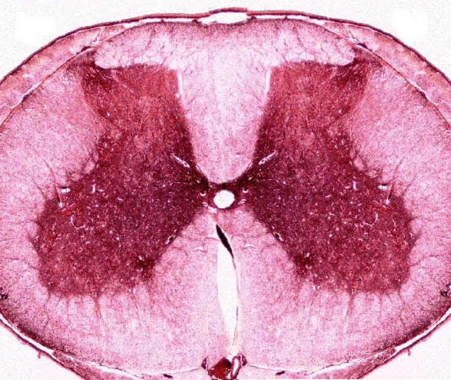 <p>Identifica la plaquita</p>