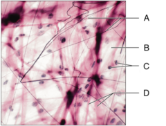 <p>A: rubberlike protein; ability to recoil back to its original form after being stretched.</p>