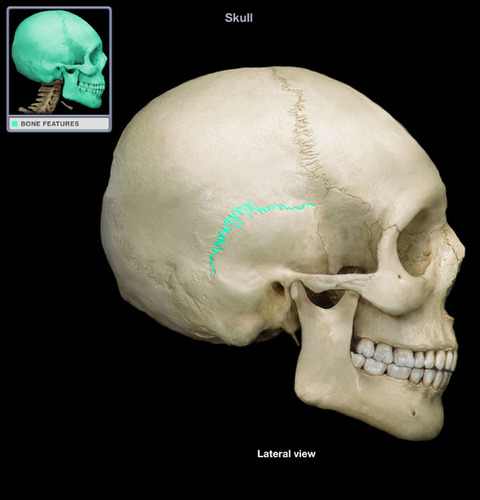 <p>What suture is this?</p>