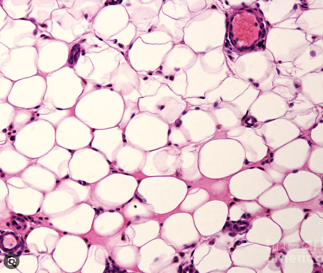 <p>What tissue is this? and where can you find it?</p>
