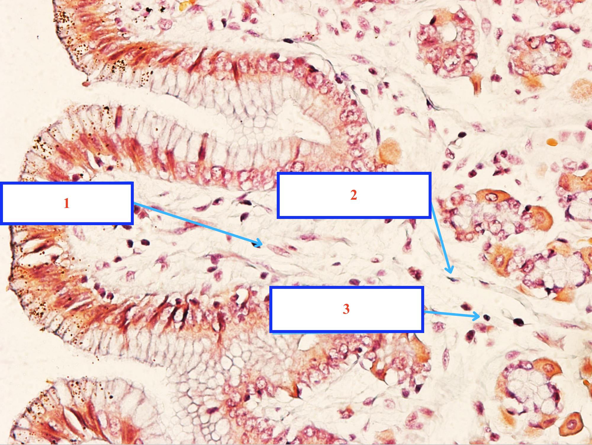 <p>Tế bào gì ?</p>