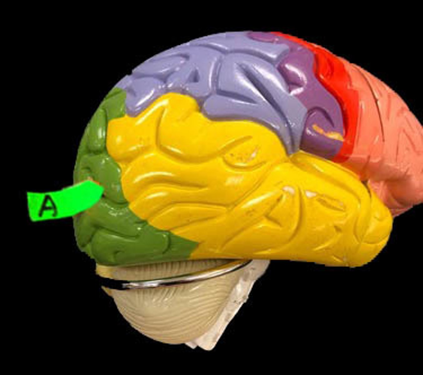 <p>Identify this lobe.</p>