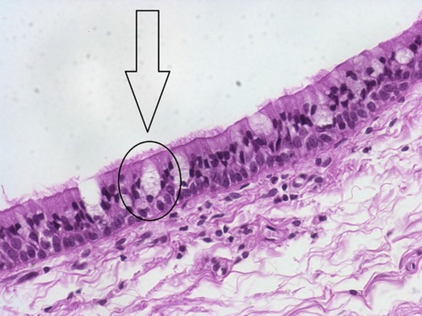 <p>what type of cell is present in the tissue?</p>