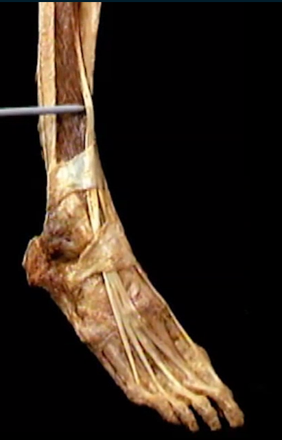 <p>Diep, boven voet</p>