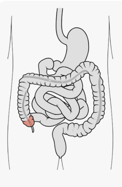 <p>Name this part of the large intestine</p>