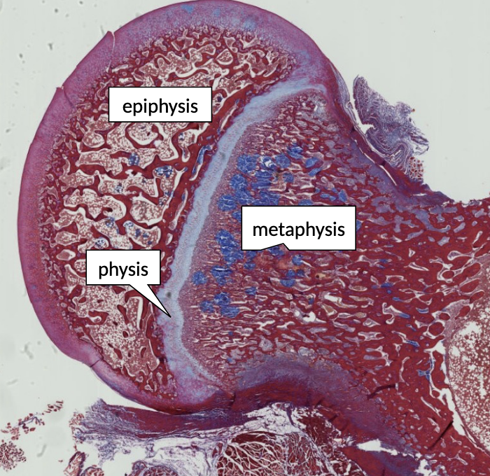 <p>this is a portion of a growing long bone, illustrating the epiphysis, physis and metaphysis. what are synonyms for “physis”?</p>