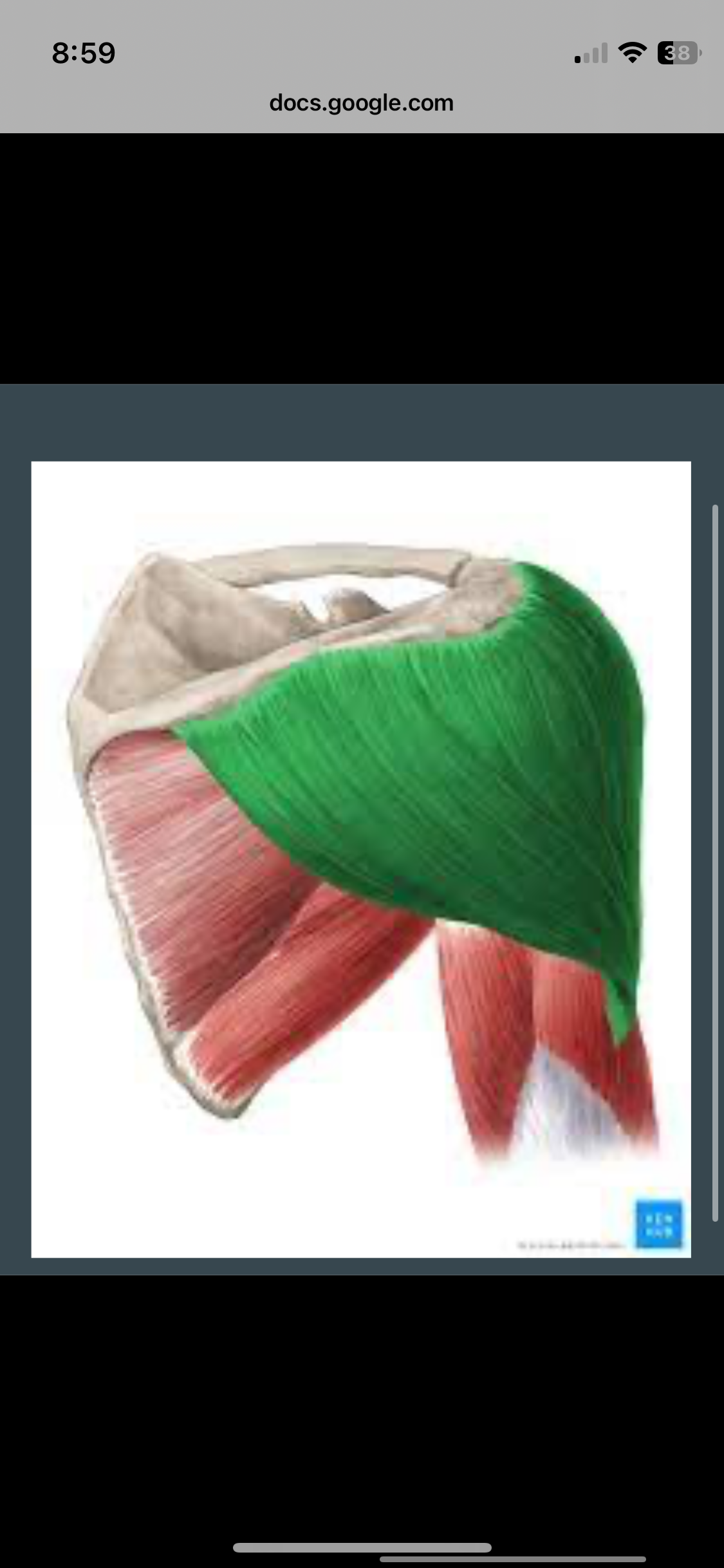 <p>Deltoid </p>
