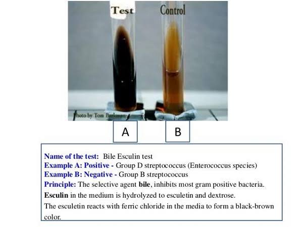 <p><mark>a selective and differential microbiological medium used primarily to isolate and presumptively identify Group D streptococci and </mark><em><mark>Enterococcus</mark></em><mark> species</mark>. It differentiates bacteria based on their ability to tolerate bile salts and hydrolyze the glycoside esculin. [1, 2, 3, 4]</p>
