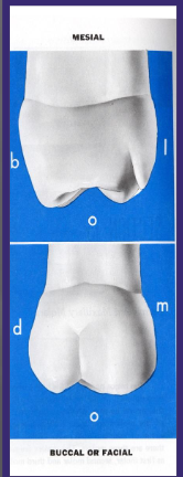 <p>2 cups seen here, MB and DB</p><p>2 buccal cusps are divided by a buccal developmental groove</p><p>The groove is not very deep, but at its end it splits into a buccal pit</p>