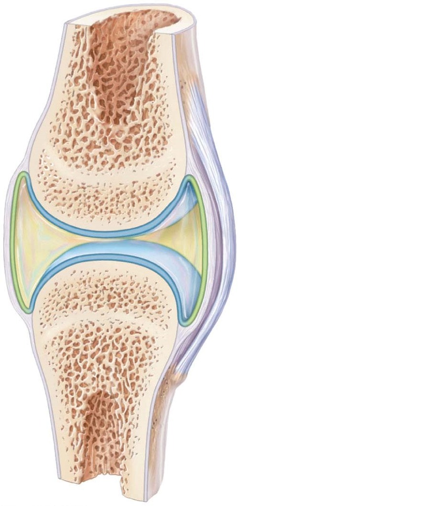 <p>Label the following:</p><ul><li><p>periosteum</p></li><li><p>articular capsule (fibrous layer and synovial membrane)</p></li><li><p>joint cavity</p></li><li><p>articular cartilage</p></li><li><p>ligament</p></li></ul><p></p>