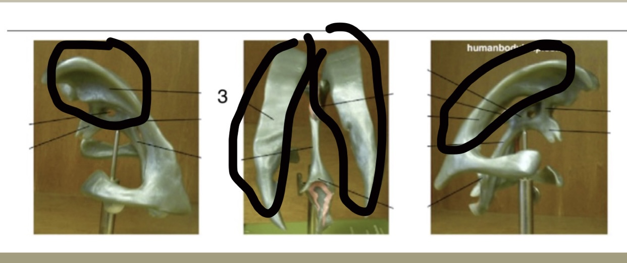 <p>Location: 2 largest ventricles; Function: Produce &amp; hold CSF (cerebrospinal fluid) </p>