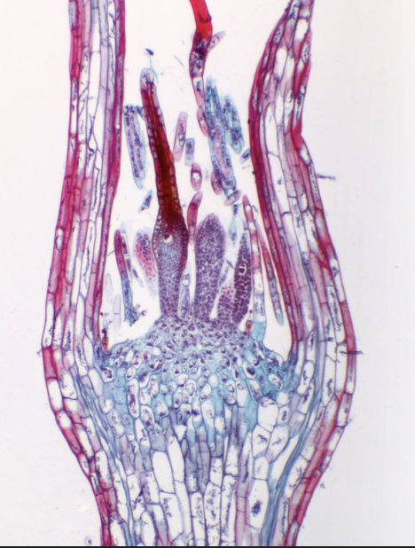 <ul><li><p><span>flask-Shaped Structure - slender neck and a swollen basal portion</span></p></li><li><p><span>The neck contains a row of neck canal cells that disintegrate at maturity to form a fluid-filled channel for sperm to swim toward the egg.</span></p></li><li><p><span>Often surrounded by sterile, hair-like filaments called paraphyses that provide protection and help maintain moisture</span></p></li><li><p><span>Because they are part of the gametophyte generation they are haploid</span></p></li><li><p><span>Resembles a tiny, hanging palm tree, with THIS hanging down with their necks oriented downward</span></p></li></ul><p></p>