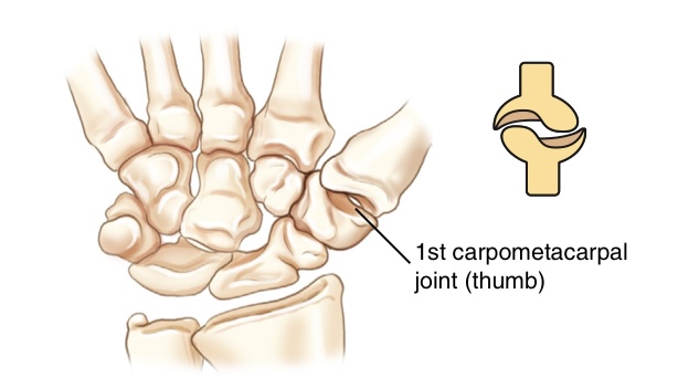<p>what movement is this joint?</p>